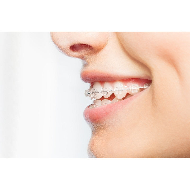 Cleo-Dent Orthodontic Wax (Transparent)