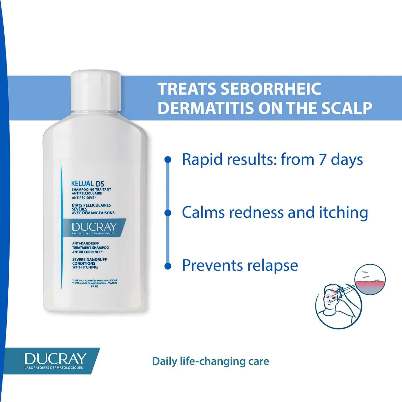 DUCRAY Kelual DS Anti-Dandruff Treatment Shampoo, Anti-Recurrence